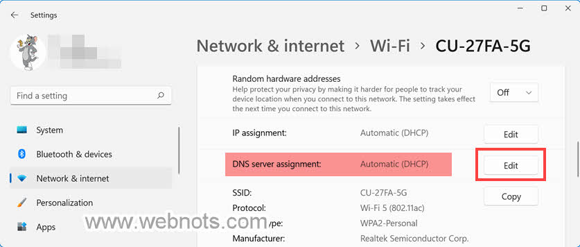 编辑 DNS 服务器分配