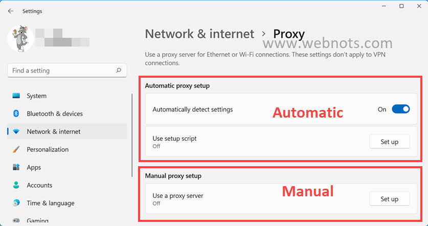 Windows 11 中的自动和手动代理设置