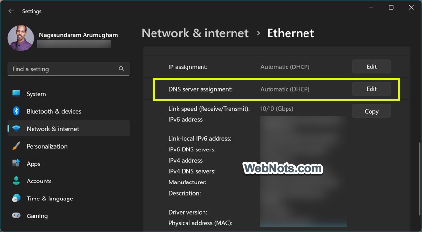 在 Windows 11 中编辑 DNS 服务器分配